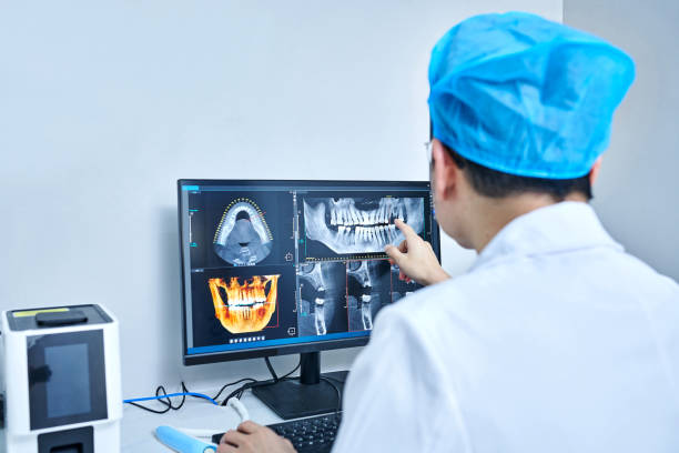 Best Emergency Wisdom Teeth Removal in Chatham, VA